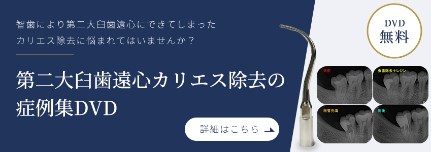 第２大臼歯遠心カリエス除去DVD